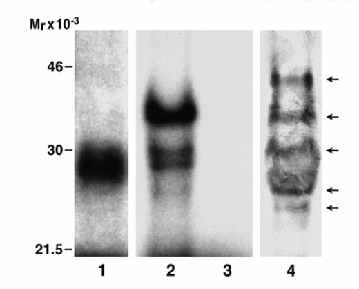 FIG. 2. Phosphorylation of mouse IGFBP-1 in conditioned media of Hepa 1-6 mouse hepatoma cells. Immunoprecipitates of IGFBP-1 from 32P-labeled conditioned media of Hepa 1-6 cells were analyzed by SDS-PAGE (lane 1) and nondenaturing PAGE before (lane 2) and after (lane 3) incubation for 2 h at 37°C with 3 U calf intestinal alkaline phosphatase. The figure shows an autoradiograph of the dried gels. For comparison, conditioned medium from Hepa 1-6 cells was subjected to nondenaturing PAGE, and the phosphoisoforms were identified by Western immunoblotting (lane 4). The upper band in lane 4 is nonphosphorylated, and the four lower bands represent phosphoisoforms. The antibody used for immunoblotting is a rabbit anti-human IGFBP-1 antibody (15) with high cross-reactivity for rat IGFBP-1 (21).