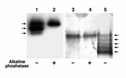 FIG. 3. Phosphorylation status of human and rat IGFBP-1 expressed after transfection into Hepa 1-6 cells. Rat and human IGFBP-1 cDNAs were transfected into Hepa 1-6 cells, as described in RESEARCH DESIGN AND METHODS. Conditioned medium from each transfectant was purified by metal affinity resin and subjected to nondenaturing PAGE. The proteins were transferred to PVDF membranes and visualized by Western ligand blotting using 125I-labeled IGF-1, as described in RESEARCH DESIGN AND METHODS. Lane 1: Rat IGFBP-1 from conditioned medium of Hepa 1-6 cells transfected with rIGFBP-1; lane 2: the same sample as shown in lane 1 after exposure to alkaline phosphatase; lane 3: human IGFBP-1 from conditioned medium of Hepa 1-6 cells transfected with human IGFBP-1; lane 4: the same samples as shown in lane 3 after exposure to alkaline phosphatase; lane 5: conditioned medium of human Hep G2 cells. The arrows on the left denote the position of the nonphosphorylated (upper arrow) and phosphorylated rat IGFBP-1. The arrows on the right indicate the positions of nonphosphorylated (upper arrow) and phosphorylated human IGFBP-1.