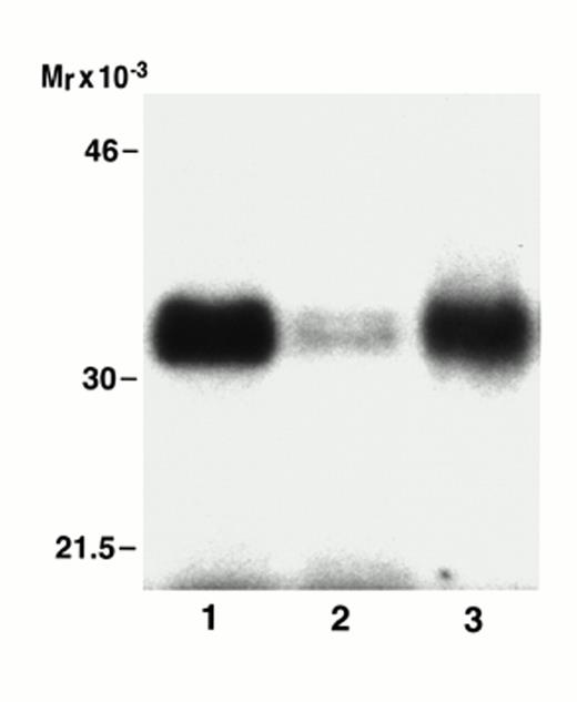 FIG. 4. Phosphorylation of mouse, human, and rat IGFBP-1 by the partially purified kinase from Hepa 1-6 cells. The partially purified protein kinase was incubated with mouse, human, or rat IGFBP-1 (50 ng) and [γ-32P]ATP for 15 min at 30°C. The reaction was terminated after the incubation by the addition of Laemmli sample buffer and boiling for 10 min. The proteins were separated by 12.5% SDS-PAGE and visualized using autoradiography. Lane 1, mouse IGFBP-1; lane 2, human IGFBP-1; lane 3, rat IGFBP-1.