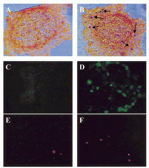 FIG. 1. Characterization of the effect of palmitic acid on β-cell death by double staining with the TUNEL assay (alkaline phosphatase) and anti-insulin antibody (peroxidase) (A and B) and by double fluorescent staining with Annexin-V—FLUOS (green) (C and D) and propidium iodide (red) (E and F). Islets were plated on extracellular matrix-coated dishes and exposed for 4 days to media containing 11.1 mmol/l glucose alone (A, C, and E) and with 0.5 mmol/l palmitic acid (B, D, and F). The arrows indicate nuclei stained positive for the TUNEL reaction (light and fluorescence microscopy × 400).