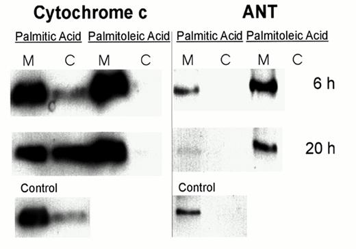 FIG. 5. Subcellular localization of ANT and cytochrome c in fatty acid-treated islets. Immunoblotting of ANT (molecular weight 30 kDa) and cytochrome c (molecular weight 15 kDa) was performed on mitochondrial (M) and cytosolic (C) fractions of islets cultured at 11.1 mmol/l glucose for 6 or 20 h with 0.5 mmol/l palmitic acid or 0.5 mmol/l palmitoleic acid. Control islets were analyzed after 20 h of incubation. Both antibodies were blotted on the same membrane after stripping. One representative of three experiments is shown.