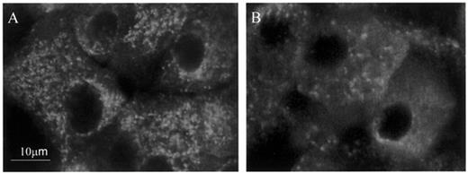 FIG. 6. Confocal images showing cytochrome c diffusely localized to the cytoplasm but not significantly to the mitochondria in palmitic acid-treated islets. Islets were plated on extracellular matrix-coated dishes and were exposed for 4 days to media containing 11.1 mmol/l glucose alone (A) and with 0.5 mmol/l palmitic acid (B) and stained with anti-cytochrome c antibody.