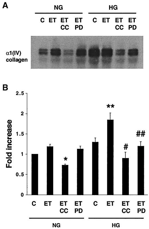 FIG. 1. Effects of Calphostin C and PD98059 on ET-1–increased expression of α1(IV) collagen mRNA in NG and HG. MCs were growth-arrested in NG or HG for 72 h, pretreated with Calphostin C (CC, 1 μmol/l for 1 h) or PD98059 (PD, 100 μmol/l for 1 h), and then stimulated with ET-1 (100 nmol/l for 16 h). α1(IV) collagen mRNA was detected by Northern blotting, as described in research design and methods. A: Northern blot of α1(IV) collagen mRNA. B: The densitometric analysis of four experiments. The results are expressed as fold stimulation of α1(IV) collagen mRNA/18S ratio over control. *P < 0.01 vs. NG + ET-1; **P < 0.05 vs. NG + ET-1; #P < 0.01 vs. HG + ET-1; ##P < 0.05 vs. HG + ET-1.