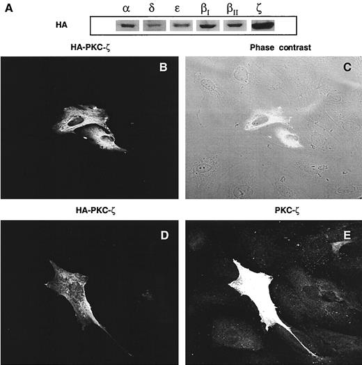 FIG. 2. Expression of HA-tagged DN-PKCs. MCs were tranfected as described in research design and methods. A: Western blot of DN-PKC expression using anti-HA antibody. B: Confocal immunofluorescence of HA-tagged DN–PKC-ζ. C: Confocal immunofluorescence of HA-tagged DN–PKC-ζ superimposed onto the corresponding phase contrast image. D and E: Confocal immunofluorescence of HA-tagged DN–PKC-ζ and a polyclonal antibody to PKC-ζ, respectively.