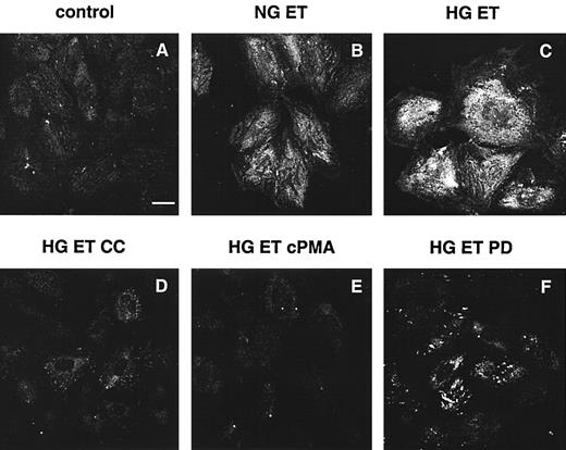 FIG. 7. ET-1 increase of α1(IV) collagen protein is enhanced in HG. Confocal immunofluorescence imaging of anti–α1(IV) collagen expressed by MCs in NG or HG and stimulated with ET-1 (100 nmol/l for 24 h). A: Absence of ET-1 stimulation. B: ET-1 stimulation in NG. C: ET-1 stimulation in HG. MCs in HG were pretreated with Calphostin C (1 μmol/l for 4 h) (D), chronic PMA (100 nmol/l for 24 h) (E), or PD98059 (100 μmol/l for 1 h) (F) and then stimulated with ET-1. Bar denotes 25 μm.