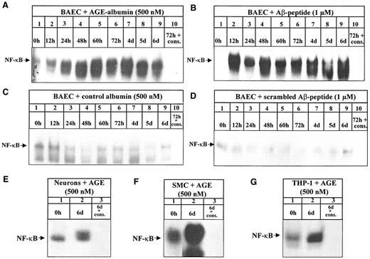 FIG. 3. Ligands of RAGE induce sustained NF-κB DNA binding activity. A–D: BAECs were left untreated (0 h) or were stimulated with AGE-albumin (500 nmol/l; A) or Aβ peptide (1 μmol/l; 1–40; B), unmodified control-albumin (500 nmol/l; C), or scrambled Aβ peptide (1 μmol/l; 40–1; D) for 12 h to 6 days. Nuclear extracts were prepared as described (see research design and methods) and assayed for NF-κB binding activity, monitored in EMSA. Radioactive labeled oligonucleotides, spanning the consensus NF-κB recognition motif, were incubated with equal protein amounts of nuclear extracts, and complexes were separated onto nondenaturing 5% PAA gels. For confirming NF-κB binding, binding observed after 72 h was competed with a 160-fold molar excess of cold consensus NF-κB oligonucleotides (cons.). The position of NF-κB is indicated by an arrow. E–G: Nuclear extract from hNT-neurons (E), SMC (F), or THP-1 cells (G), harvested before (0 h) or 6 days after AGE-albumin stimulation (500 nmol/l) (6 days) were subjected to NF-κB–specific EMSA. NF-κB binding was confirmed by competing the shift observed after 6 days with a 160-fold molar excess of cold consensus NF-κB oligonucleotides (cons.). The position of NF-κB is indicated by an arrow.