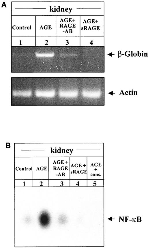 FIG. 5. AGE-mediated induction of NF-κB DNA binding activity in vivo is dependent on RAGE. A: Mice transgenic for an NF-κB–controlled β-globin reporter gene (78) were infused once with 1,000 μg of AGE-albumin (500 μg i.v.; 500 μg i.p.) or control albumin (500 μg i.v.; 500 μg i.p.). At time points 0 and 3 days, mice were treated with RAGE IgGs (40 μg/mouse i.v.) or sRAGE (25 μg/mouse i.v.). After 6 days, mice were killed and total RNA from the kidney was prepared and 2 μg were analyzed by RT-PCR for β-globin transgene and β-actin expression (β-globin transgene [top, 440 bp] and β-actin [bottom, 720 bp]). B: Nuclear extracts were prepared from the other kidney of the above β-globin transgenic mice. Ten micrograms of each nuclear extract were analyzed for NF-κB (p50/p65) binding activity in EMSA using a 32P-radiolabeled oligonucleotide with the high-affinity NF-κB(p50/p65) consensus sequence. The inducible NF-κB complex is indicated by an arrow. For confirming NF-κB–binding, kidney nuclear extracts from AGE-treated transgenic mice was competed with a 160-fold molar excess of unlabeled NF-κB consensus oligonucleotides (lane 5).