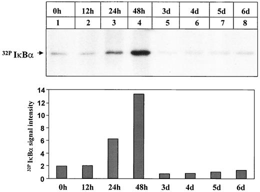 FIG. 9. AGE-albumin induces an IκBα phosphorylating kinase activity. BAECs were left untreated (0 h) or were stimulated with AGE-albumin (500 nmol/l) for 12 h to 6 days. Total cell extracts were prepared and incubated with recombinant IκBα for 30 min at 37°C in the presence of 10 μCi [γ-32P]ATP. Subsequently, the reaction was immunoprecipitated with IκBα-specific antibodies and analyzed by SDS-PAGE and autoradiography.
