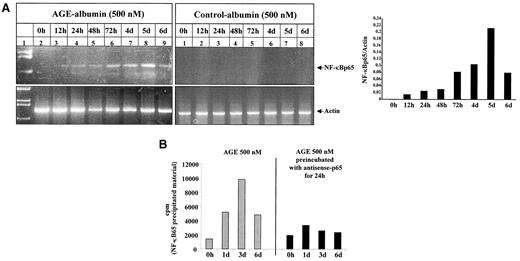 FIG. 10. AGE-albumin induces accumulation of NF-κBp65 mRNA and de novo synthesis of NF-κBp65 antigen in endothelial cells. A: BAECs were left untreated (0 h) or were stimulated with AGE-albumin (500 nmol/l, left) or control albumin (500 nmol/l, right) for 12 h to 6 days. Total RNA was prepared, and 2 μg of each preparation was analyzed by RT-PCR with primers specific for NF-κBp65 (top, 680 bp) and β-actin (bottom, 720 bp), respectively (for details, see research design and methods). The left lane (SM) shows the 564- to 947-bp fragment of a λ-DNA EcoRI-HindIII digest. The signals obtained in AGE-albumin–stimulated BAECs were analyzed by densitometry and are expressed as the ratio of NF-κBp65 to β-actin. B: BAECs were left untreated (0 h) or were stimulated with AGE-albumin (500 nmol/l) for 24 h, 72 h, or 6 days in the absence (left) or presence (right) of 0.1 μmol/l antisense p65 oligonucleotides. Four hours before harvest, the medium was changed to methionine-free medium for 1 h. Thereafter, medium was changed again to DMEM supplemented with 7 μCi/ml l-[35S]methionine. At the end of incubation, intrinsic labeled cells were harvested, lysed, and subjected to NF-κBp65–specific immunoprecipitation (for details, see research design and methods). Incorporation of l-[35S]methionine into NF-κBp65–precipitated material was determined in a β-counter. The experiment was repeated twice with similar results.