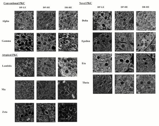 FIG. 5. In situ PKC isoenzyme expression in P. obesus β-cells. Pancreatic sections from hyperglycemic (DP-HE), prediabetic-normoglycemic(DP-LE), and diabetes resistant (DR-HE) P. obesus were immunostained with isoenzyme-specific antisera and image analyzed using laser-scanning confocal microscopy. Positive β-cell identification was achieved by counterstaining with insulin antiserum (not shown).