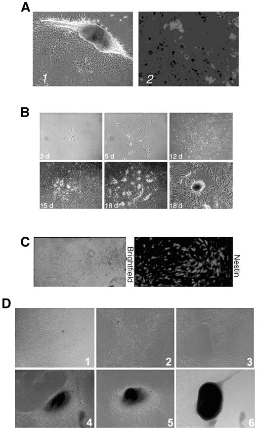 FIG. 2. Isolation and proliferation of NIP cells. A: Isolation of NIP cells. Panel 1: A rat islet cultured for 8 days in modified RPMI 1640 media containing 20 ng/ml bFGF and EGF showing outgrowth of the monolayer of cells. Original magnification ×100. Panel 2: Dual fluorescence immunostaining of the cell monolayer outgrowing from rat islets using antisera to nestin (Cy3) and insulin (Cy2). B: Proliferation and formation of SCs in rat cultures. Five to ten cells were picked from the monolayer shown in A and subcloned by cylindrical cloning. Two-day cultures show that the cells have attached. Then, cells proliferate and reach confluence by day 12. They then migrate (15 days) and form SCs by day 18. The last panel (bottom right) is a magnified image of an SC. C: NIP cells subcloned (passage 1; day 5) from human islets and immunostained with antisera to nestin (Cy3). D: Sequence of events leading to the formation of SCs in human NIP cell cultures. Cells were picked from the outgrowth surrounding a human islet and subcloned. The cells become confluent (panel 1), migrate (panel 2), and form vacuolated structures (panel 3). Next, cells around these spaces become round, forming dense bodies (panel 4), which become larger (panel 5), and eventually form SCs (panel 6).