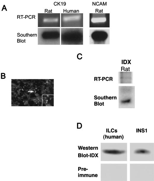 FIG. 3. Differentiation of rat and human NIP cells toward an endocrine or duct phenotype. A: The DNA products (upper panels) of the correct predicted sizes generated by RT-PCR of NIP RNA using amplimers to rat (690 bp) or human (1 kb) CK19 and rat NCAM (326 bp). The authenticity of the DNA products was verified by Southern blot hybridization using 32P-labeled CK19 and NCAM, respectively (lower panels). B: Expression of homeodomain protein IDX-1 in human SCs derived from NIP cells. Immunocytochemistry (Cy3 immunofluorescence) in SCs (after treatment with bFGF plus EGF for 17 days, then incubation with Activin-A plus HGF for 2 weeks) using an antiserum to IDX-1. Bright punctate structures are immunopositive nuclei throughout the SCs (inset; original magnification ×400). Preimmune serum control staining of human SCs were negative (not shown). C: RT-PCR of mRNA prepared from SCs. DNA product (553 bp) obtained by RT-PCR (top panel) was confirmed by Southern blot hybridization (bottom panel). D: Western immunoblot of protein extract (positive control) prepared from human SCs derived from NIP cells (left) compared with extract prepared from a rat clonal β-cell line (INS1) (right) using an antiserum to IDX-1 (upper panels) or preimmune serum (lower panels). The exposure was longer for the Western blot prepared for human NIP cells.
