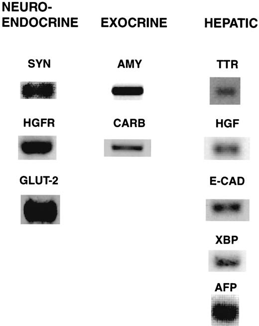 FIG. 5. Expression of neuroendocrine, exocrine pancreatic, and hepatic markers in human NIP cultures containing SCs. RT-PCR of RNA prepared from human NIP cultures (cultured in the absence of serum for 9–12 days) was performed using oligonucleotides (see research design and methods) for human synaptophysin (SYN), HGF receptor (HGFR) or c-MET, GLUT-2, pancreatic amylase (AMY), procarboxypeptidase (CARB), transthyretin (TTR) (induced when cultures were treated with 10 μmol/l dexamethasone), HGF, E-cadherin (E-CAD), XBP-1, and α-fetoprotein (AFP). The identities of each band was confirmed by Southern blotting with 32P-labeled oligonucleotides (data not shown).