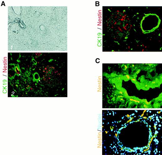 FIG. 6. Nestin-positive cells are expressed in localized regions of the ducts in the rat pancreas. A: Phase contrast (panel 1) and dual immunofluorescence immunostaining (panel 2) using antisera to CK19 (green) and nestin (red) of a section of a pancreas from a 60-day-old rat (P60). (Original magnification ×100.) The arrows in panel 2 point to localized regions of the ducts that express nestin (red) or coexpress nestin and CK19 (yellow). Note that the islet contains cells are immunostained for cytokeratin (green) or nestin (red) but not both. Also note that there are nestin-positive cells scattered about in the exocrine parenchyma, probably consisting of cells in centroacinar ductules. B: Section of rat pancreas showing islets and ducts stained with antisera to nestin (red) and CK19 (green). Original magnification ×200. C: High magnification of a large duct in a section of a rat pancreas. The top panel shows immunostaining with antisera to nestin (yellow in pseudocolor), and the lower panel shows coimmunostaining for nestin (yellow in pseudocolor) and nuclei stained with Hoechst (blue).