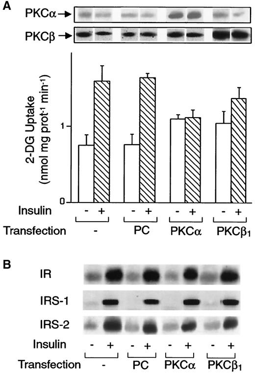FIG. 5. Effects of overexpression of PKC-α and -β in L6 cells. A: Wild-type L6 myotubes were transfected with either PKC-α or PKC-β cDNAs or with the empty vector (PC) and then exposed to 100 nmol/l insulin as indicated. The cells were then assayed for 2-DG uptake as outlined in the legend of Fig. 4. For control, the expression of PKC-α and -β levels was also checked by immunoblotting aliquots of the cells (50 mg protein/aliquot) with specific PKC antibodies (inset). Bars represent the means ± SD of triplicate determinations in four independent experiments. B: Cells transfected with PKC-α or PKC-β1 and control cells were exposed to 100 nmol/l insulin for 10 min, solubilized as described under research design and methods, precipitated with insulin receptor (IR), IRS-1, or IRS-2 antibodies, and then blotted with phosphotyrosine antibodies. The specific bands were revealed by ECL. The autoradiograph shown is representative of three independent experiments.