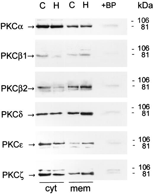 FIG. 1. Representative Western blot analysis of PKC-α, -β1, -β2, -δ, -ε, and -ζ showing translocation from cytosolic (cyt) to membrane (mem) fraction. These fractions were extracted from cardiac myocytes exposed to 5 (C) or 25 mmol/l (H) glucose for 12 h. The quantity of protein loaded was 25 μg (cytosolic) and 50 μg (membrane). Blocking peptides (+BP) for each of the isozymes are also shown.