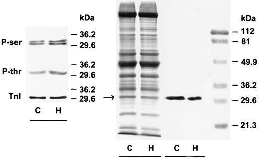 FIG. 7. Left: A representative Western blot depicting Tn I phosphorylation in extracts from adult rat ventricular myocytes exposed to 5 (C) or 25 (H) mmol/l glucose. Phosphorylation of serine (P-ser) and threonine (P-thr) residues was enhanced in myocytes exposed to 25 mmol/l glucose for 12 h. Center: SDS-PAGE of cardiac myocyte homogenate (25 μg protein) from C and H maintained for 12 h. The 29–31 kDa band corresponds to the molecular weight of Tn I. Right: The protein band at 29–31 kDa was excised, equilibrated with SDS buffer, and subjected to 10% SDS-PAGE. The identity of the protein was confirmed by Western blot analysis with a monoclonal cardiac Tn I antibody.