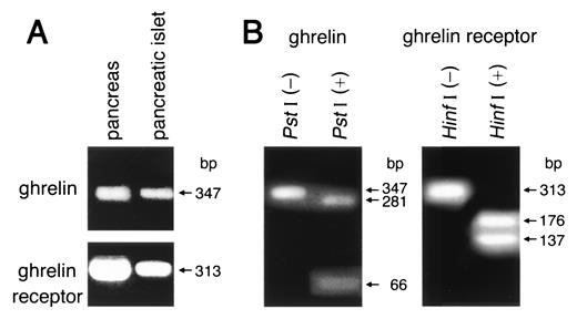 FIG. 3. A: Representative electrophoretic analysis patterns of the RT-PCR products of ghrelin (top) and ghrelin receptor mRNA (bottom) in rats. B: The PCR product of ghrelin digested with PstI [lane PstI (+)] or not [lane PstI (−)] and that of the ghrelin receptor digested with HinfI [lane HinfI (+)] or not [lane HinfI (−)].