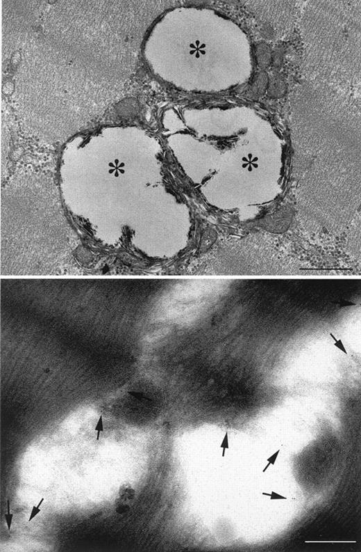 FIG. 5. Upper panel: immunogold particle staining of the membrane after incubation with an antibody against the human 65-kDa mitochondria membrane protein. The magnification bar is 0.5 μm. Bottom panel: higher magnification view of the vacuoles observed in skeletal muscle from some individuals with type 2 diabetes or obesity, and noted to have a double-membrane structure consistent with mitochondria. The magnification bar is 0.28 μm.