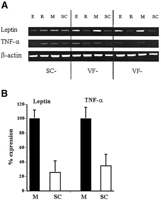 FIG. 4. Gene expression of TNF-α and leptin. Measurements were performed in epididymal (E), perinephric (R), mesenteric (M), and SC fat after extraction of VF (VF−) or SC fat (SC−). RT and real-time PCR analysis for TNF-α, leptin, and β-actin are described in research design and methods. A: Example of agarose gel analysis of RT-PCR products from different fat depots in SC− and VF− rats. B: Analysis of all real-time PCR data obtained in all rats, corrected for intensity of β-actin and presented in arbitrary units. P < 0.001 vs. mesenteric fat.