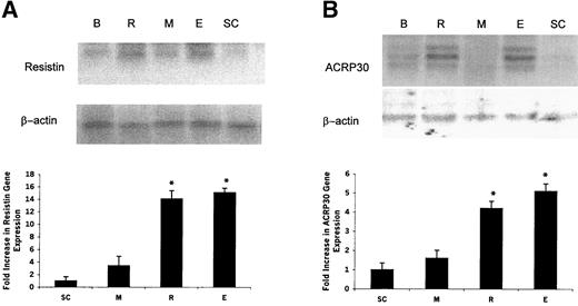FIG. 5. Gene expression of resistin (A) and ACRP30 (B). A: Northern blot analysis of brown (B), epididymal (E), perinephric (R), mesenteric (M), and SC fat obtained from SC− rats. B: Real-time PCR data obtained from all rats corrected for the intensity of β-actin and presented in arbitrary units. *P < 0.01 vs. M and SC.