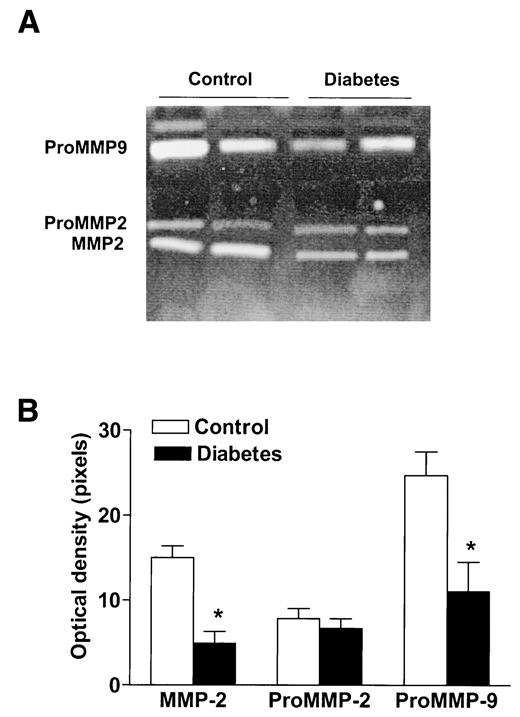 FIG. 1. A: A representative SDS-PAGE zymogram from control and diabetic IMA samples. MMP activity as determined by white lytic bands was detected at the 90- to 60-kDa region. B: Densitometric analysis of lytic bands detected in gelatin zymograms were plotted as mean ± SE of 14 subjects in each group. *P < 0.05 vs. control.