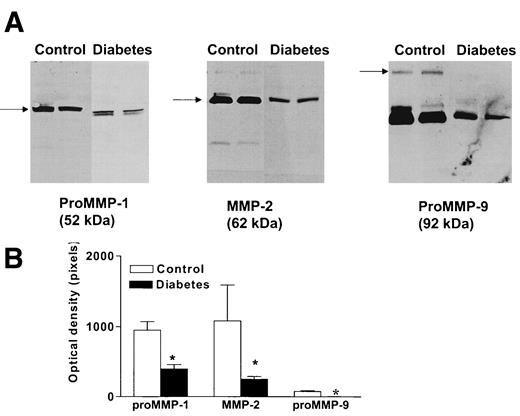 FIG. 2. A representative immunoblot demonstrating the presence of MMPs in vascular tissue. Control (n = 14) and diabetic (n = 14) IMA samples were subjected to immunoblotting for MMP-1, -2, and -9. A: Immunoreactive bands corresponding to the molecular weight of pro-MMP-1, MMP-2, and MMP-9 were detected and indicated by the arrows. A low molecular weight band (∼60 kDa) was also observed with MMP-9 antibody and most likely represents a degradation product. B: Densitometric analysis of immunoreactive bands indicates that MMP proteins are decreased in diabetic tissue; n = 14. *P < 0.05 vs. control.