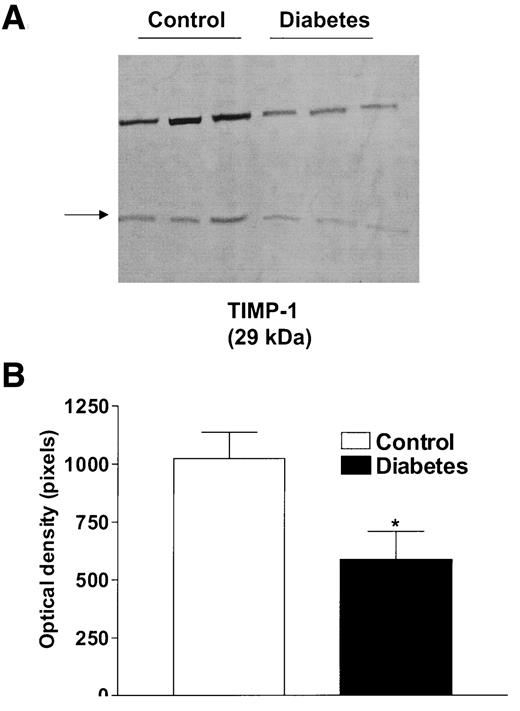FIG. 4. Expression of TIMP-1 in control and diabetic vascular tissue. A representative immunoblot demonstrating decreased TIMP-1 (29 kDa) levels in the diabetic tissue (A) and densitometric analysis of all cases (n = 6 in each group; B). *P < 0.05 vs. control.