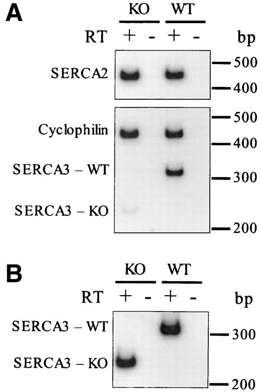 FIG. 2. Comparison of SERCA2 and SERCA3 mRNA levels by RT-PCR in isolated islets from SERCA3 +/+ (WT) and SERCA3 −/− (KO) mice. A: After reverse transcription (RT+) of islet total RNA, SERCA3 and SERCA2 cDNAs were amplified for 22 cycles under semiquantitative conditions. Cyclophilin was used as an internal control gene and amplified in duplex with SERCA3. SERCA2 mRNA expression was not affected by SERCA3 ablation. Compared with the 316-bp product in islets from wild-type mice, the shorter SERCA3 amplicon in SERCA3 −/− islets only gave a faint band under these conditions. B: SERCA3 cDNA was amplified for 40 cycles to confirm the presence and size of the shorter SERCA3 amplicon in islets from knockout mice. No PCR products were amplified when reverse transcriptase was omitted from the reverse transcription reaction (RT−). The results of both panels are representative of experiments performed on islets from two mice.