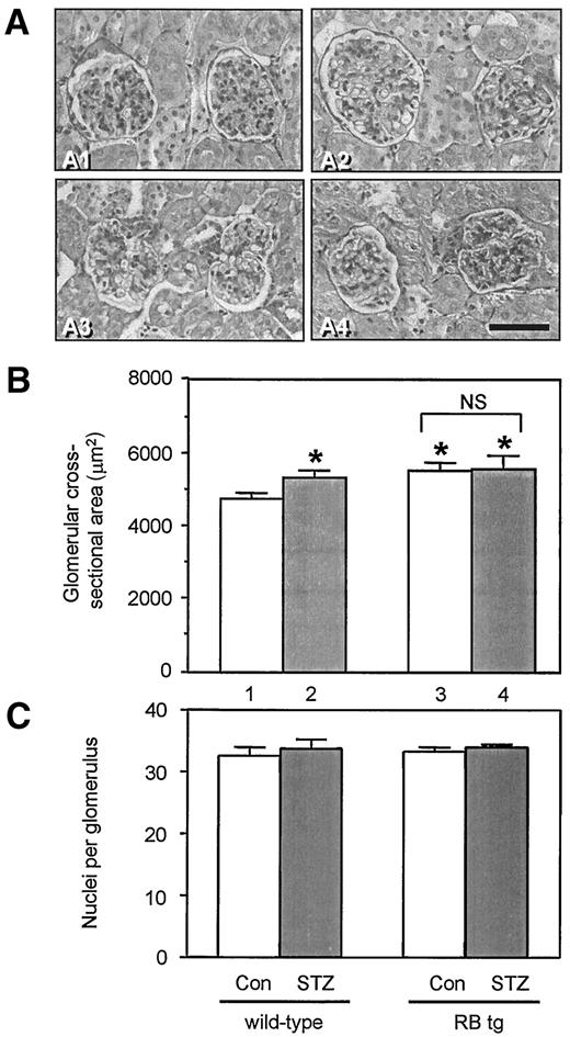 FIG. 2. Glomerular hypertrophy accompanies whole-kidney hypertrophy in diabetic mice and in mice overexpressing RB. A: Representative photomicrographs of kidney sections 9 days after four consecutive daily injections with citrate buffer (control) or STZ in citrate buffer. PAS stain; bar = 100 μm. A1: Wild-type mouse, citrate buffer alone. A2: Wild-type mouse made diabetic with STZ. A3: RB transgenic mouse, citrate buffer. A4: RB transgenic mouse made diabetic with STZ. B: Quantification and comparison of glomerular size. Glomerular cross-sectional areas were measured from kidney sections stained with hematoxylin and eosin or PAS. The histograms represent means ± SE from examining 25–60 individual glomeruli in sections from four individual mice in each group. *P < 0.01 vs. wild-type control (lane 1). C: Quantification and comparison of glomerular cellularity. Total numbers of nuclei per glomerular cross-section were counted in histological sections from the same mice. Neither STZ-induced diabetes nor RB overexpression resulted in any significant hypercellularity at 9 days. tg, transgenic.