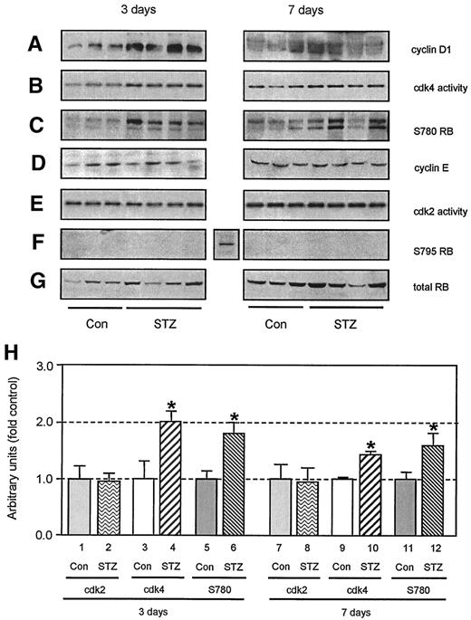 FIG. 3. Increased cyclin D1 expression, cdk4 activity, and cdk4-directed RB phosphorylation in renal cortices from diabetic mice and from mice overexpressing RB from a transgene. Mice were killed 3 or 7 days after induction of diabetes by STZ. A: Cyclin D1 expression by immunoblotting. B: Cdk4 activity, using GST-p56RB as a substrate, was measured as described in research design and methods. C: RB phosphorylated on Ser 780 was measured by immunoblotting with a specific anti-Ser780-phospho-RB monoclonal antibody. D and E: No significant change in cyclin E expression or cdk2 activity. F: RB phosphorylated on Ser 795 was detected in the same lysates using another specific anti-phospho-RB antibody. A positive control for expected RB phosphorylation on Ser 795, lysate from rapidly cycling 786-O renal cell carcinoma cells, was included in the middle panel. G: Total RB expression was measured by immunoblot using rabbit polyclonal antibody C15, which recognizes both endogenous murine RB and human transgenic RB proteins (28). H: Histograms represent means ± SE from quantification of blots from the renal cortices of six control and seven diabetic mice, only some of which are shown in panels B, C, and F. *P < 0.05 vs. control mice.