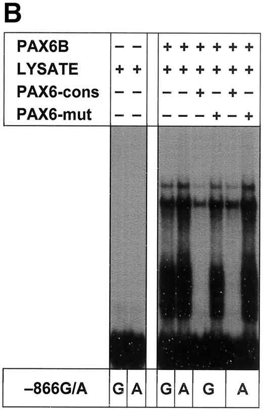FIG. 1. PAX6 preferentially binds to and more effectively trans activates the variant −866A UCP2 promoter allele. A: Electrophoretic mobility shift assays with nuclear extracts prepared from INS1-E and COS-7 cells. Extracts were incubated with α32P-labeled double-stranded oligonucleotides corresponding to the −866G and −866A alleles of UCP2 (−866G: 5′-TGGCTGTTCACGCGTCAGTTACCCCCACAGG-3′; −866A: 5′-TGGCTGTTCACGCATCAGTTACCCCCACAGG-3′). Competition studies included the following double-stranded competitor probes: PAX6 consensus sequence probe (PAX6-cons), 5′-GCATtTTCACGCATgAGTgcaCag-3′; mutated PAX6 consensus sequence probe (PAX6-mut), 5′-GcaTtTTCAgcCATgAGTgcaCag-3′; PAX4 consensus sequence probe (PAX4-cons), 5′-GcgcGgTgAtGCGTgtGcagCggC-3′; IPF1 consensus sequence probe from rat glucokinase element 1 (IPF1-cons), 5′-GCccagtAgaCATtAGcacCtCgC-3′; and −866A. Upper case letters indicate sequence homology with the UCP2 promoter. The relative location of the −866G/A UCP2 promoter polymorphism is shown in upper case underlined. Letters in lower case italics indicate mutations introduced into the PAX6 core consensus sequence. Studies with three different extracts showed identical results. B: Electrophoretic mobility shift assays with in vitro translated PAX6B and unprogrammed reticulocyte lysate as control. C: Anti-PAX6 Western blot showing the presence of PAX6 protein in nuclear extracts isolated from INS1-E (lane 1) and COS-7 (lane 2) cells. Lanes 3 and 4: In vitro translated PAX6B as positive and unprogrammed reticulocyte lysate as negative control. D: Indirect immunofluorescence staining of PAX6 and insulin on INS1-E cells with anti-PAX6 (middle) or anti-insulin (right) antibody, detected by a TRITC- or FITC-conjugated secondary antibody, respectively. A phase contrast image is shown on the left. Scale bar = 25 μm. E and F: INS1-E cells (E) or COS-7 cells (F) cotransfected with UCP2 promoter constructs −866G or −866A and, as indicated, PAX6A/PAX6B expression plasmids or the empty pcDNA6/V5-His plasmid backbone. RLU, relative luciferase units, where activity of the −866G construct was set to 1.0. Results are representative for one of three independent experiments, each with greater than or equal to five replicates. ▪, −866G reporter construct; □, −866A reporter construct; means ± SD.
