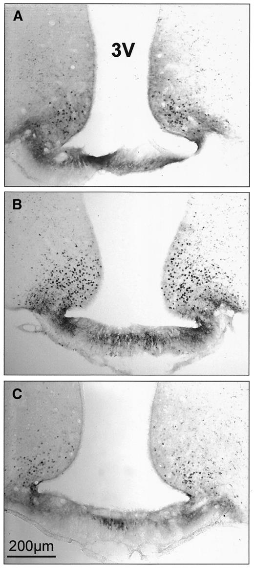 FIG. 1. Photomicrographs showing GHRP-6-induced Fos protein immunoreactivity in the arcuate nucleus of Wistar rats fed ad libitum and infused centrally with saline for 6 days (A), fasted for the last 48 h of ICV saline infusion (B), and fasted for the last 48 h of ICV insulin infusion (C). 3V, 3rd ventricle.
