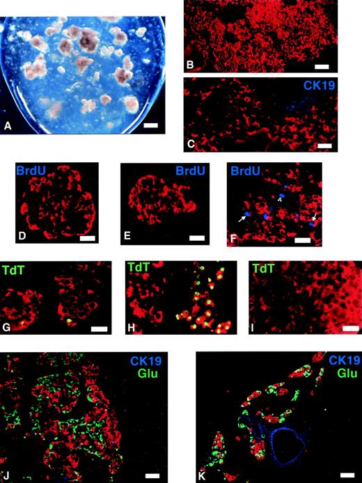 FIG. 1. A: Photomicrograph of a fibrin gel containing ∼50 islets 2 h after polymerization of a 5-μl fibrinogen solution containing the islets with 5 μl thrombin. B–I: Immunohistochemical analysis of islets fixed after 6 days. Most cells in the fibrin gels stain for insulin (red) (B). Only rare staining for CK19 (blue) was observed (C), indicating that there were very few ductal cells present. Seventy-two hours after addition of BrdU, no labeled nuclei were observed in either free-floating islets with growth factors (D) or islets cultured in fibrin in the absence of growth factors (E). When the growth factor cocktail was added to the fibrin gels, scattered nuclear labeling (blue) could be seen throughout the gel (F). Arrows indicate insulin-containing cells, and the arrowhead indicates non-insulin-containing cells. Apoptotic nuclei were occasionally seen in intact free-floating islets (G), and many in disintegrating free-floating islets (H), but none in islet cells in fibrin gels (I). J and K: Immunohistochemical analysis of islet grafts 1 month after transplantation. J: Islets that had been previously cultured in fibrin gels; large grafts were full of compact clusters of endocrine cells, mostly insulin (red) and some glucagon (green). Only rare staining for CK-19 (blue) was seen. For comparison, islets cultured free floating gave rise to smaller grafts, with scattered endocrine cells (K). In some areas, ductal structures (blue CK-19 staining) could be seen. Bar = 120 μm in A; 60 μm in B, J, and K; 30 μm in C–F; and 15 μm in G–I.