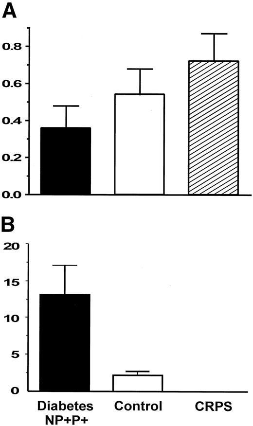 FIG. 2. NE spillover in foot (A; pmol · dl−1 · min−1) and ratio of arm to foot spillover (B). (No ratio for CRPS is given, because the data in arm and foot spillover refer to different individuals.).