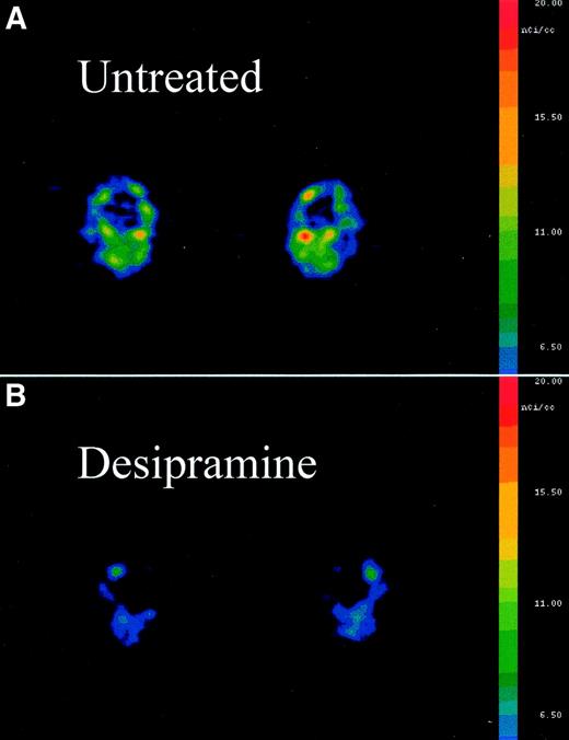 FIG. 3. Representative 6-[18F]fluorodopamine PET scans of the feet of a normal volunteer untreated (A) and after treatment with oral desipramine (B). The scale for both images is the same.