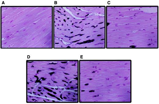 FIG. 5. Evidence for PARP activation in diabetic rat hearts. Immunohistochemical staining for poly(ADP-ribose) formation, an indicator of PARP activation, in control (A), diabetic (B and D), and PJ34-treated diabetic (C and E) rat hearts. Panels B and D show poly(ADP-ribose) formation localized in the nuclei of myocytes in 5- and 10-week diabetic rat hearts, respectively. The evidence of poly(ADP-ribose) accumulation can be seen as dark, frequent, and widespread nuclear staining in panels B and D. Treatment with PJ34 for 4 weeks (C) markedly reduced PARP activation in diabetic (5-week) hearts. Notably, the PARP activation in diabetic hearts (10 weeks) was attenuated even after the discontinuation of the treatment with PJ34 (after 6 weeks) for an additional 3-week period (E). Similar immunohistochemical profiles were seen in n = 4–5 hearts per group.