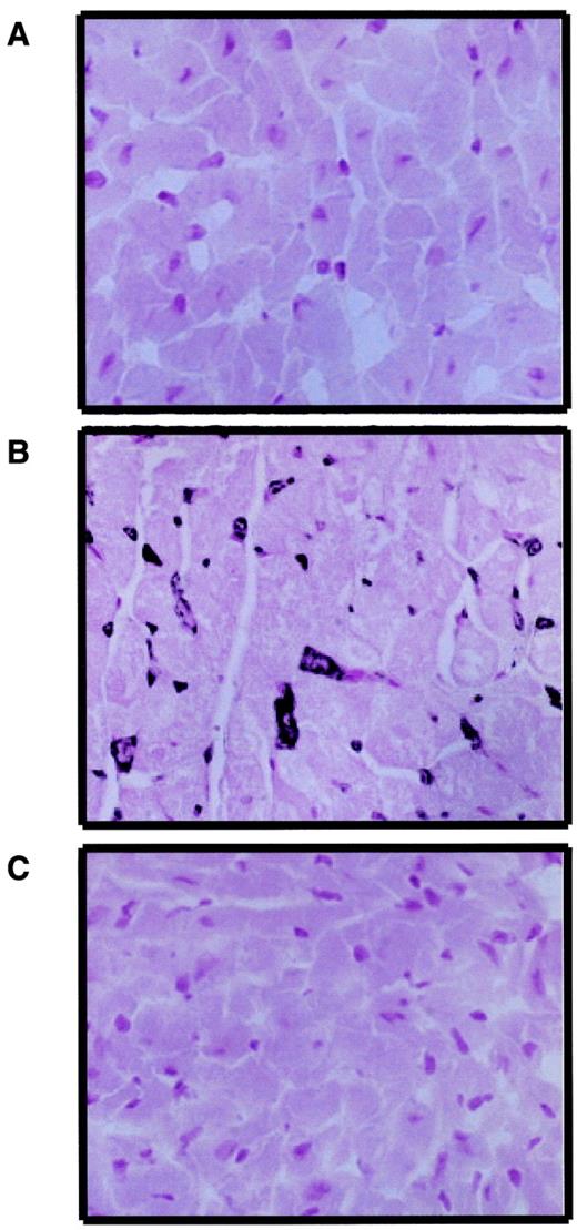 FIG. 6. Evidence for PARP activation in diabetic mouse hearts. Immunohistochemical staining for poly(ADP-ribose) formation, an indicator of PARP activation, in control (A), diabetic (B), and PJ34-treated diabetic (C) mouse hearts. The evidence of enhanced poly(ADP-ribose) activity can be seen as dark, frequent, and widespread nuclear staining in panel B. Similar immunohistochemical profiles were seen in n = 4–5 hearts per group.