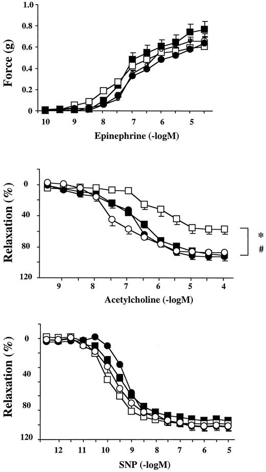 FIG. 7. Reversal of diabetes-induced endothelial dysfunction by pharmacological inhibition of PARP in diabetic NOD mouse vascular rings. Epinephrine-induced contractions (upper panel), acetylcholine-induced endothelium-dependent relaxation (middle panel), and sodium nitroprusside-induced endothelium-independent relaxations (lower panel). ▪, control; ○, control + PJ34; □, diabetes; •, diabetes + PJ34. Each point of the curve represents the means ± SE of 5–8 experiments in vascular rings. *P < 0.05 vs. C; #P < 0.05 vs. D.