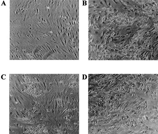 FIG. 5. Cellular morphology of human SC preadipocytes cultured for 15 days in DM + vehicle (A), DM + rosiglitazone (10−7 mol/l; B), DM + LG100268 (10−7 mol/l; C), or DM + rosiglitazone (10−7 mol/l) and LG100268 (10−7 mol/l; D).