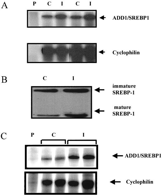FIG. 1. Effect of insulin on human SREBP1 expression and cleavage. A: Effect of 24-h insulin treatment (100 nmol/l) on SREBP1 mRNA expression in isolated human subcutaneous adipocytes. Representative example of two subjects from study group B. B: Effect of insulin on SREBP1 protein in human isolated adipocytes. Western blot analysis. Adipocyte cell lysates from mature subcutaneous adipocytes cultured for 24 h in the presence or absence of 100 nmol/l insulin for 24 h. Lysates were obtained from patients in study group B. C: RNase protection analysis comparing SREBP1 mRNA in vastus lateralis of lean subjects before and after a 3-h hyperinsulinemic clamp. Samples were obtained from patients in study group D. C, control; I, insulin; P, probe.