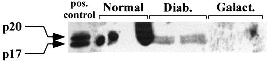 FIG. 4. Activation of cas-3 at 8 months’ duration of diabetes. Lysates from retinas of diabetic, galactose-fed, and normal animals at 8 months’ duration of diabetes were separated in a 4–20% gradient gel under reducing conditions and probed against the cleaved subunits of cas-3 as described in research design and methods. The antibody detects (shown by the positive control) both the inactive p20 subunit and the active p17 subunit of cas-3. No specific stain was detected in either the normal controls or the galactosemic animals. The figure represents the result of two individual animals of each experimental group.