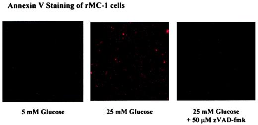 FIG. 7. Caspase inhibition prevents hyperglycemia-induced apoptosis in rMC. rMC-1 cells were incubated in low (5 mmol/l) and high (25 mmol/ l) glucose in the presence or absence of zVAD-fmk (50 μmol/l) for 3 days. Cells were stained with annexin V as described in research design and methods. The figure represents the result of three similar experiments.