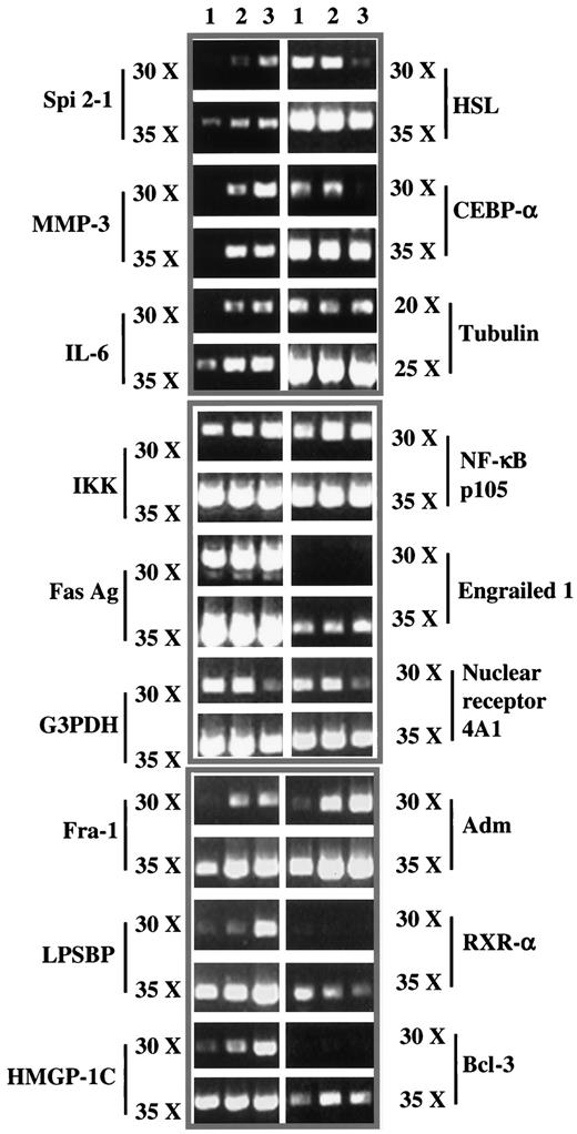 FIG. 3. Semi-quantitative RT-PCR. 3T3-L1 adipocytes were treated with TNF-α (1 nmol/l) for 0, 4, and 24 h. Total RNAs were extracted, and a sample of first-strand cDNA was synthesized from 1 μg total RNA. Then various gene-specific primers were used to amplify target genes using equal amounts of the first strand cDNA as template. PCR reaction was performed for 30 and 35 cycles, unless otherwise indicated, to identify the linear range for PCR. Lane 1, control condition; lane 2, TNF-α 4 h; lane 3, TNF-α 24 h. Fas Ag, Fas antigen; G3PDH, glycerol-3-phosphate dehydrogenase; NF-κB p105, NF-κB p105 subunit.