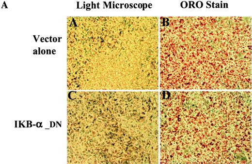 FIG. 6. Expression of IκBα-DN does not affect adipocyte differentiation but IκBα-DN is resistant to TNF-α-induced phosphorylation and degradation. A: Stable 3T3-L1 cell lines expressing the retroviral vector or mutant IκBα-DN protein were established as described in research design and methods, and were induced to differentiate into adipocytes according to standard protocols. Unstained cells or cells stained with Oil Red O (ORO) were examined using an inverted-phase contrast microscope and photographed. B: 3T3-L1 adipocytes expressing vector or IκB-DN were treated with TNF-α (1 nmol/l) for 0, 5, 15, and 60 min. Total cell lysate were prepared, and 40 μg total cellular protein was analyzed by SDS-PAGE and immunoblotted with anti-IκB-α and anti-phospho-IκB-α antibodies. The blot was stained by Ponceau S to verify sample equal loading.
