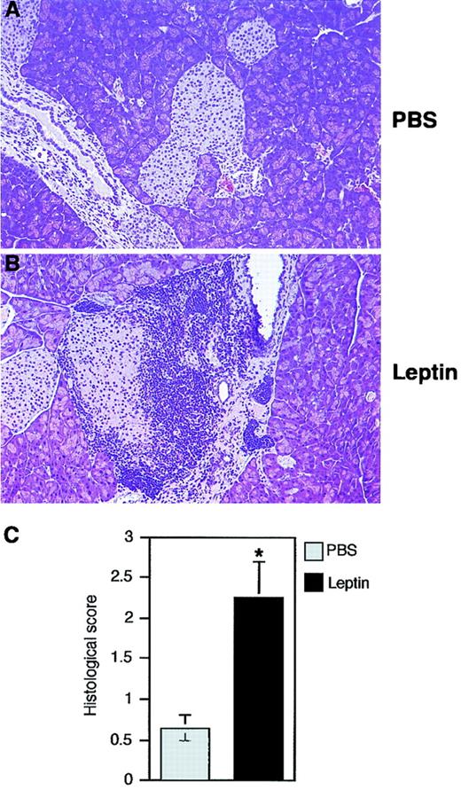 FIG. 3. Leptin administration leads to early islet inflammatory infiltration in NOD mice. Hematoxylin and eosin staining of pancreata from control NOD mice (A) and leptin-treated mice (B) at 5 weeks of age. Magnification: 200×. C: Insulitis score of leptin- and PBS-treated control mice (*P < 0.001, Mann-Whitney U test) is expressed as mean ± SD. Pancreatic islets of leptin-treated mice are heavily infiltrated (B and C), whereas matched controls mostly have normal islets (A and C).