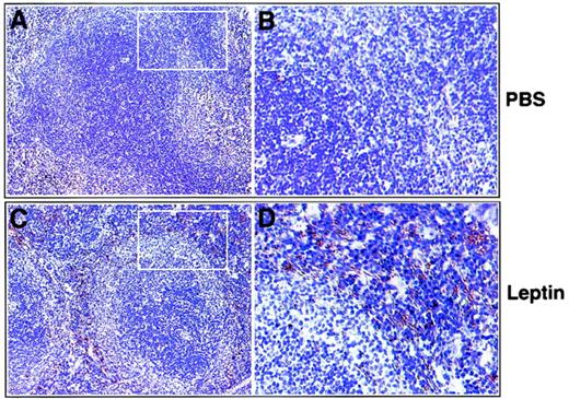 FIG. 4. Early administration of leptin increases T-cell-mediated IFN-γ mRNA expression in NOD mice. In situ hybridization for the presence of IFN-γ in spleens of PBS-treated controls (A, B) and leptin-treated mice (C, D). More IFN-γ mRNA expression (in brown) is found within the periarteriolar sheaths (T-cell areas) of leptin-treated mice (C, D) than controls (A, B). Magnification: 200× (A, C) and 800× (B, D). The white squared areas in A and C represent the zone of higher magnification shown in B and D, respectively. Representative experiment of three.