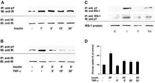 FIG. 1. TNF-α inhibits insulin-induced tyrosine phosphorylation of IR in cultured mouse skeletal myotubes. Studies were performed on 6-day-old cultured myotubes, which were transferred to serum-free low-glucose Eagle’s medium, 24 h before experiments were conducted. A: Time course of insulin-induced tyrosine phosphorylation of IR in control cells. Protein extracts from untreated cultures or insulin-stimulated cultures treated for various time periods (1, 5, 15, or 30 min) were immunoprecipitated with specific antiphosphotyrosine antibodies. Immunoprecipitates were run on SDS-PAGE, transferred to Immobilon-P membranes, and immunoblotted with specific anti-IR antibodies. B: Effects of pretreatment with TNF-α on insulin-induced tyrosine phosphorylation of IR. Protein extracts were prepared from untreated cultures or cultures stimulated with insulin for 5 min with and without prior treatment with TNF-α (1 nmol/l) for 5, 15, or 30 min. Extracts were immunoprecipitated with specific antiphosphotyrosine antibodies. Immunoprecipitates were run on SDS-PAGE, transferred to Immobilon-P membranes, and immunoblotted with specific anti-IR antibodies. The Western blots shown are representative of three blots from three separate cultures. C: TNF-α inhibits insulin-induced tyrosine phosphorylation of IRS-1 in cultured mouse skeletal myotubes. Cells were either untreated (C) or treated with insulin for 5 min (I), with 1 nmol/l TNF-α for 5 min (T), or with TNF-α for 5 min before addition of insulin for 5 min (T+I). Extracts were immunoprecipitated with specific antiphosphotyrosine antibodies. Immunoprecipitates were run on SDS-PAGE, transferred to Immobilon-P membranes, and immunoblotted with specific anti–IRS-1 antibody. The Western blots shown are representative of three blots from three separate cultures. D: TNF-α inhibits insulin-induced glucose uptake. Myotubes were transferred to serum-free low-glucose medium for 24 h. Cells were either untreated or treated with insulin for 20 min, with 1 nmol/l TNF-α for 5 or 30 min, or with TNF-α before addition of insulin. The results are described as percent of control. Glucose transport was evaluated by measuring [3H]-2DG for 15 min as described in research design and methods. Data are presented as percent of basal (18 ± 1.3 pmol · mg protein−1 · min−1), which was set at 100%. Each bar represents the means ± SE of triplicate values in each of three experiments performed on separate cultures.