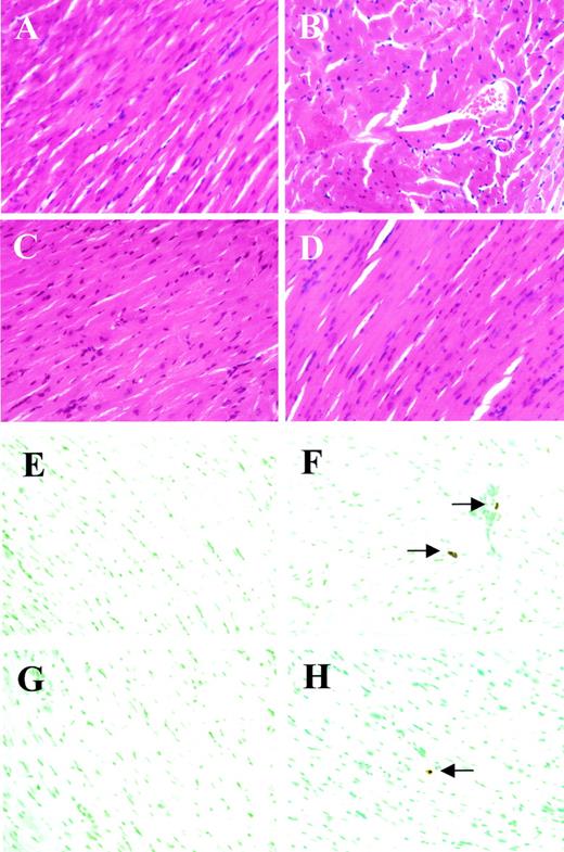 FIG. 1. Gross morphology and TUNEL detection of apoptotic cells in the heart of diabetic mice. Heart tissues from normal (saline; A and E), STZ-induced diabetes (B and F), STZ control (C and G), and insulin-supplemented diabetic (D and H) mice were sectioned at 5 μm. These slides were processed for H & E staining (A–D) and TUNEL assay to detect apoptotic cells (E–H).