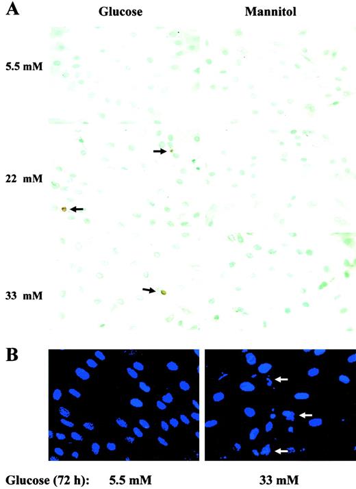FIG. 4. Detection of apoptotic cells in the H9c2 cells treated with high levels of glucose. H9c2 cells were cultured on chambered slides for 24 h and then treated with 5.5, 22, and 33 mmol/l glucose or 5.5, 22, and 33 mmol/l mannitol for different time periods for TUNEL assay (A) and DAPI staining (B). A: Representative slides from cultured H9c2 exposed to low or high levels of glucose or mannitol for 96 h. Black arrows indicate apoptotic cells detected by TUNEL, and white arrows indicate the fragmented and condensed nuclei by DAPI staining.